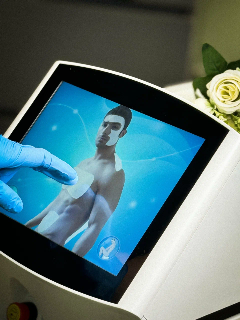 Профессиональное оборудование для лазерной эпиляции в студии Боди Лайн